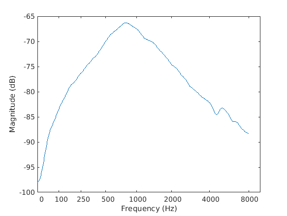 middleearfilter_1_1.png