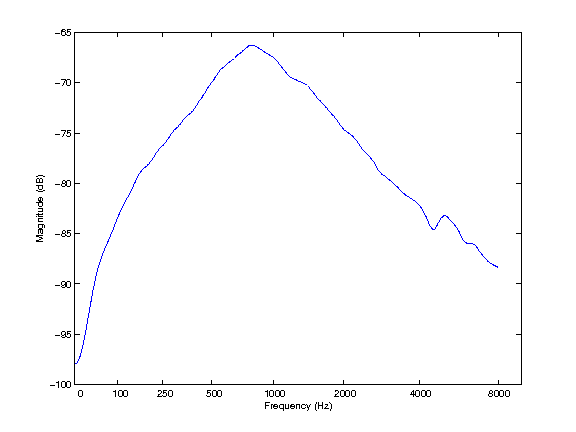 middleearfilter_1_1.png